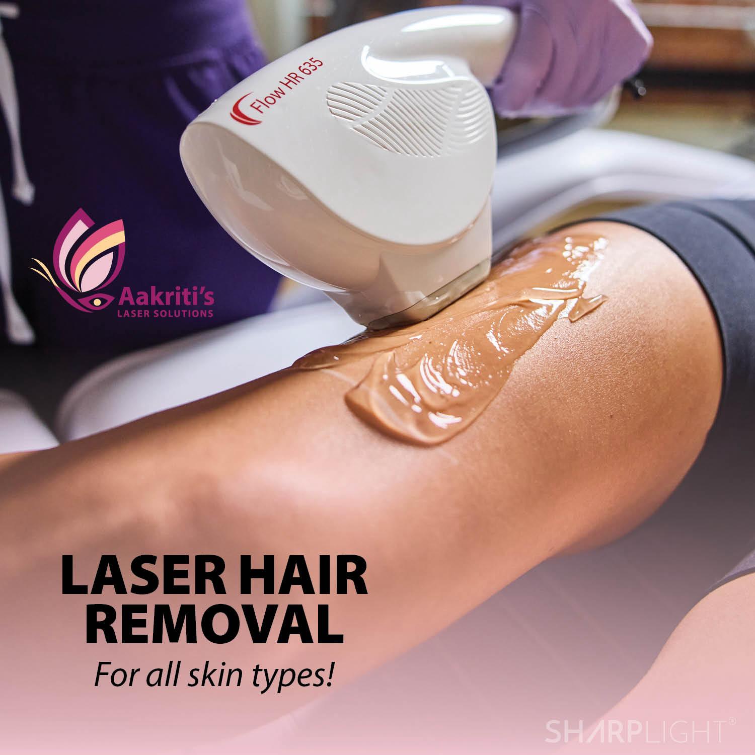 Facial Laser